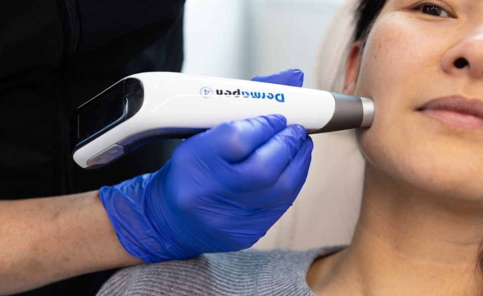 Dermal Needling with Dermapen®4