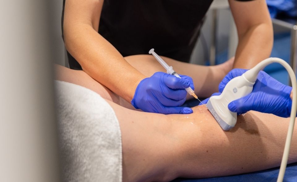 Ultrasound Guided Sclerotherapy (UGS)